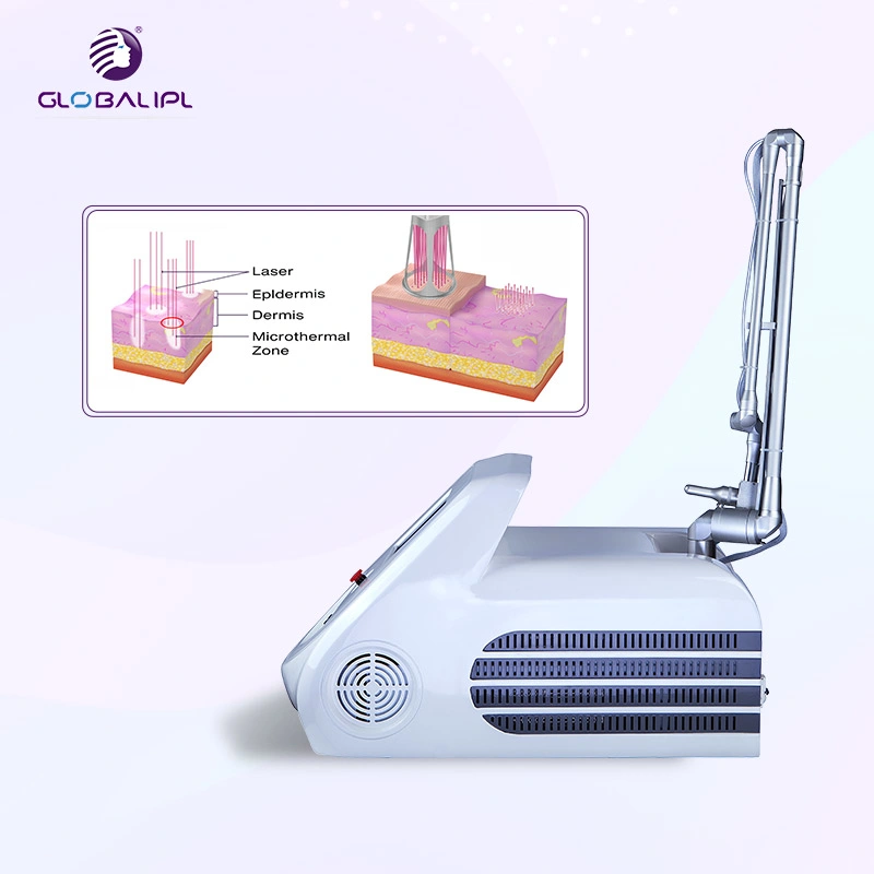 Vaginal Tightening Stretch Marks Removal Skin Resurfacing Fractional CO2 Laser Machine