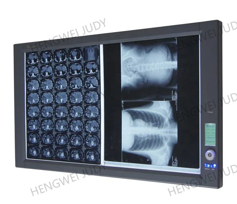 Manufacturer Medical LED X-ray Film Illuminator Dental X-ray Viewer Oral Therapy Equipments & Accessories 30W Class I 4500~5500K