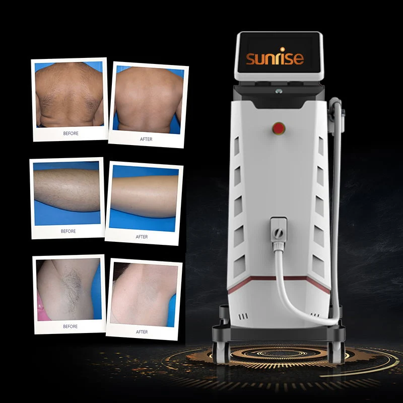 Best Sale Diode 808nm Laser Hair Removal / 808nm Diode Hair Removal Laser Machine Beauty Machine