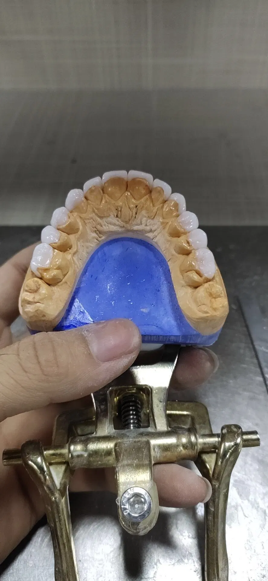 Les revêtements réalisés en Chine Dentaire Dental Lab avec de très haute qualité et Aestheic