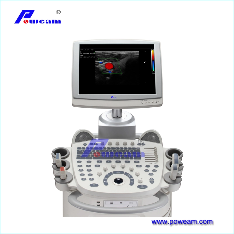 Цена ультразвуковой установки для 3D Portable Color Doppler