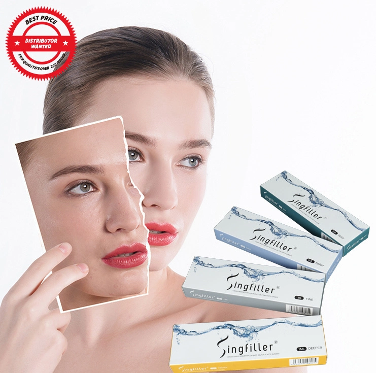 Singfiller Hyaluronic Acid Dermal Filler Plastic Surgery Implants for Lips, Nasolabial Folds, Cheek Enhancement