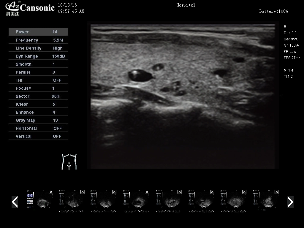 Portable Color Doppler Ultrasound Scanner for Cardiology