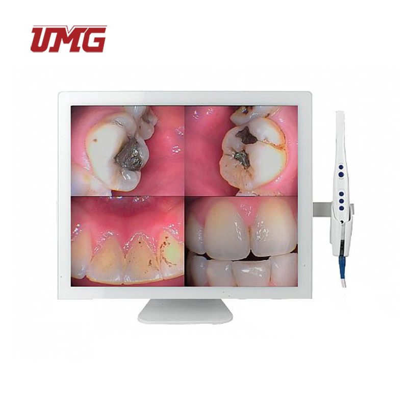 Dental Camera Intra Oral Video Recording Dental Intraoral Endoscopy