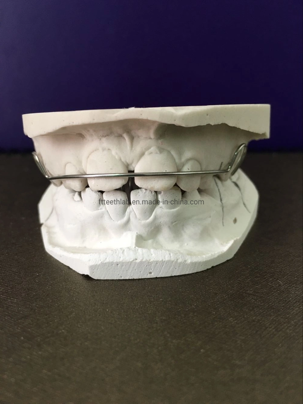 Habit Breaker Thumb Appliance From China Dental Lab