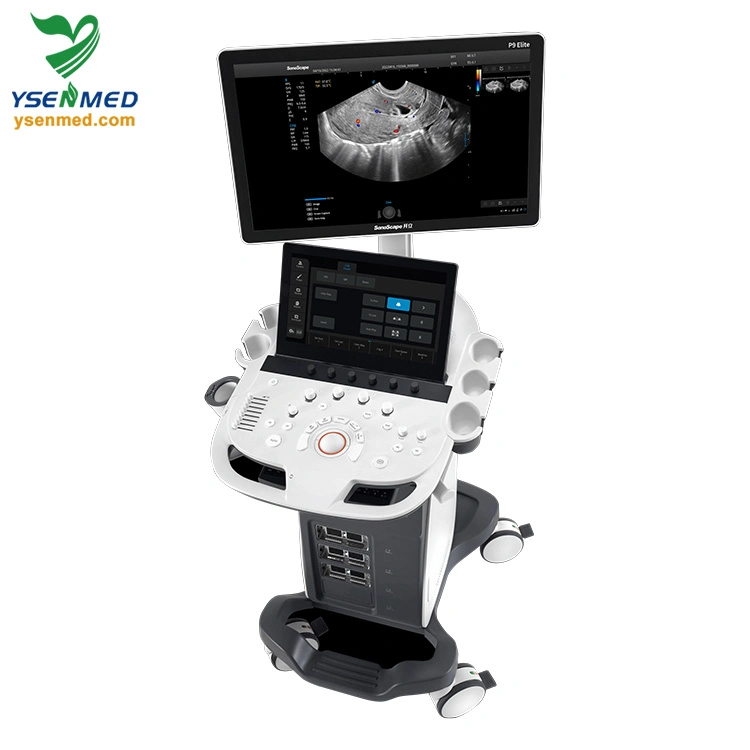 Sonoscape P9 Elite Trolley 3D/4D Color Doppler Ultrasound Machine Medical Equipment