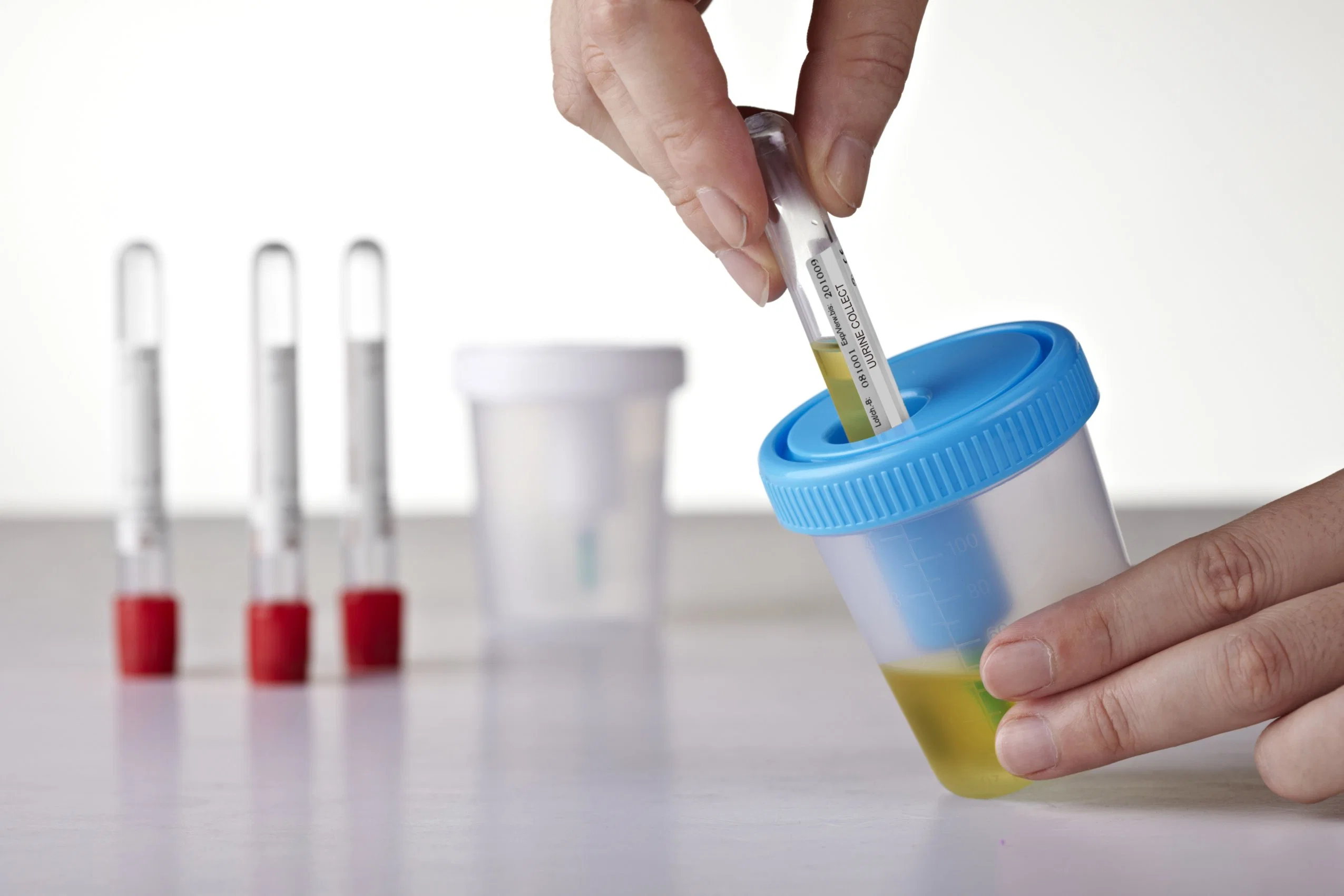 Urine Specimen Collection Cup Container with Needles and Tube