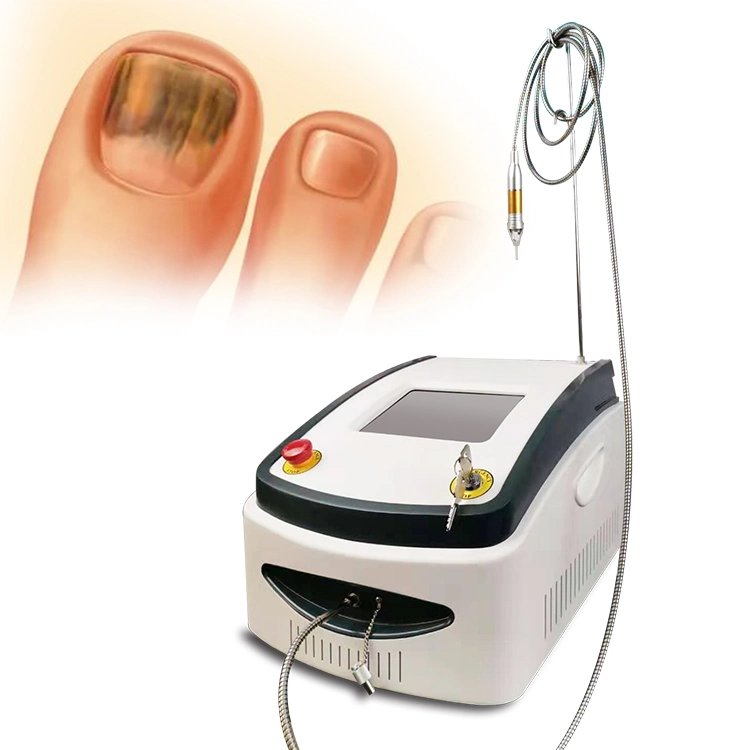 Mejor Venta 980nm Diodo Laser Nails Fungus tratamiento Fisioterapia plantar Eliminación de verrugas