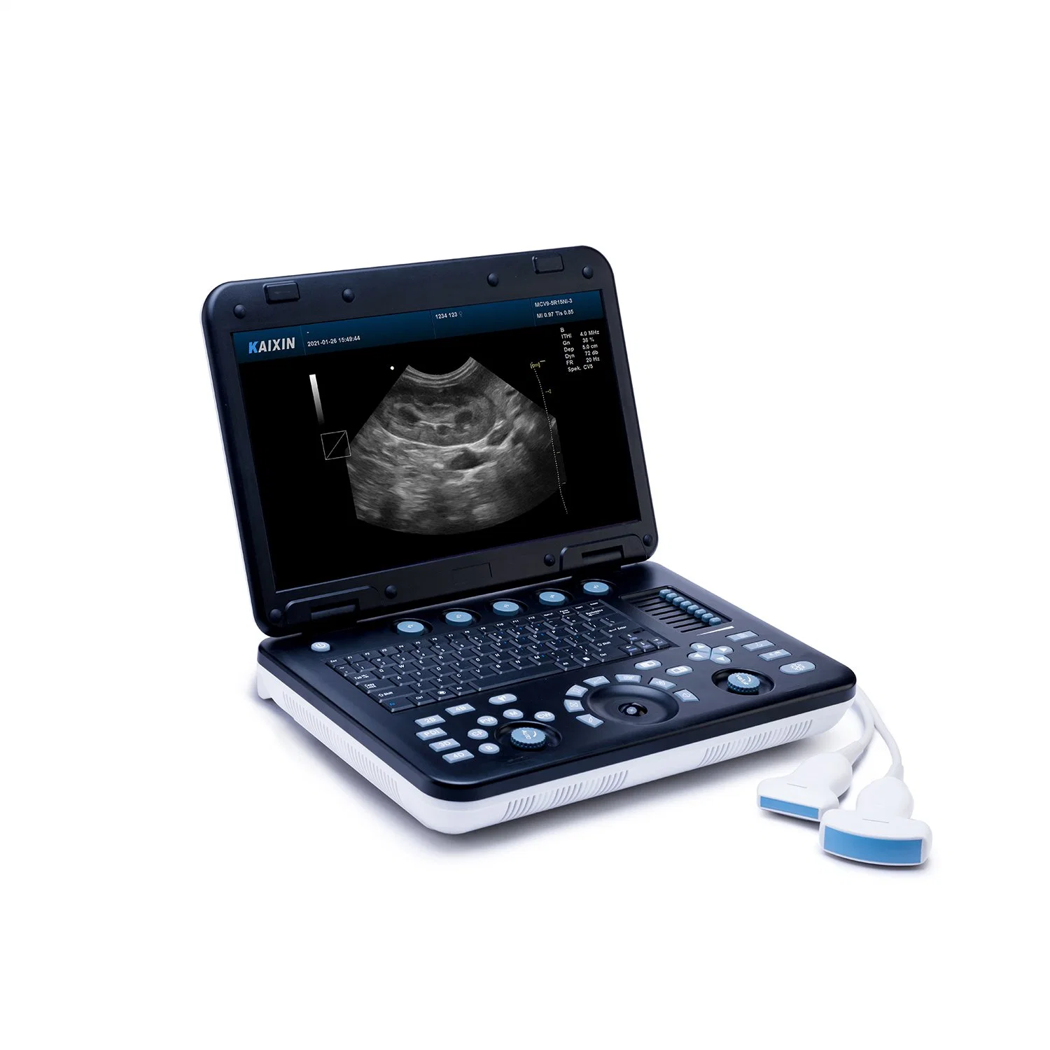 Kaixin Portable 3D/4D Color Dopppler Ultrasound Scanner