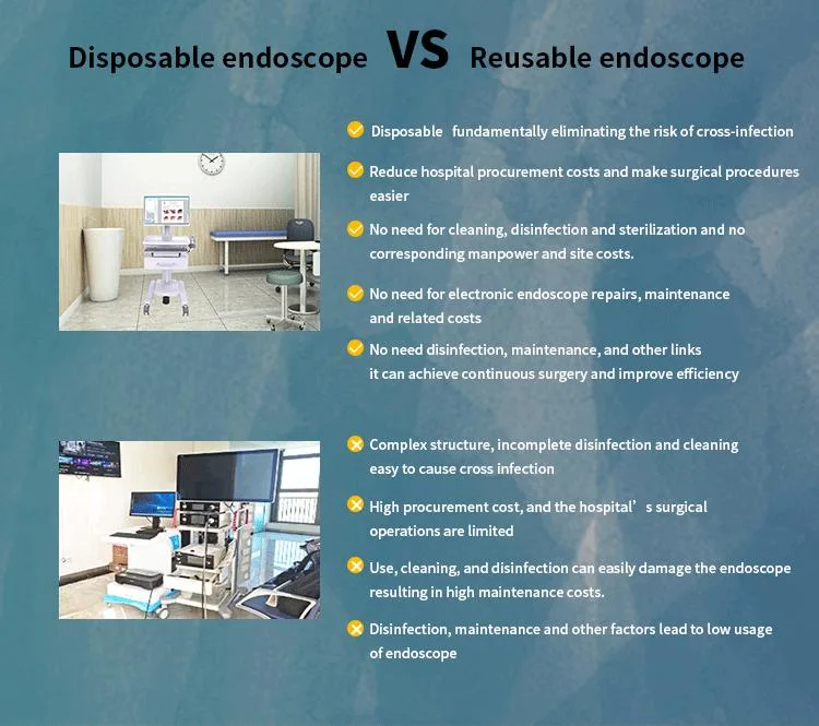 Discount Ent Imaging Equipment 1080P HD Endoscope Camera System