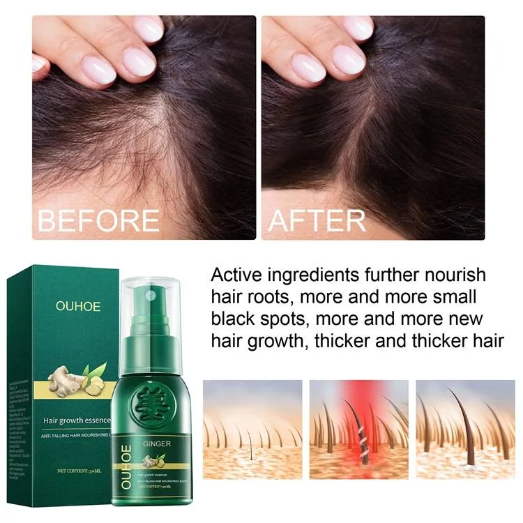 Anti Loss Ginger Serum Hair Growth Essence Spray