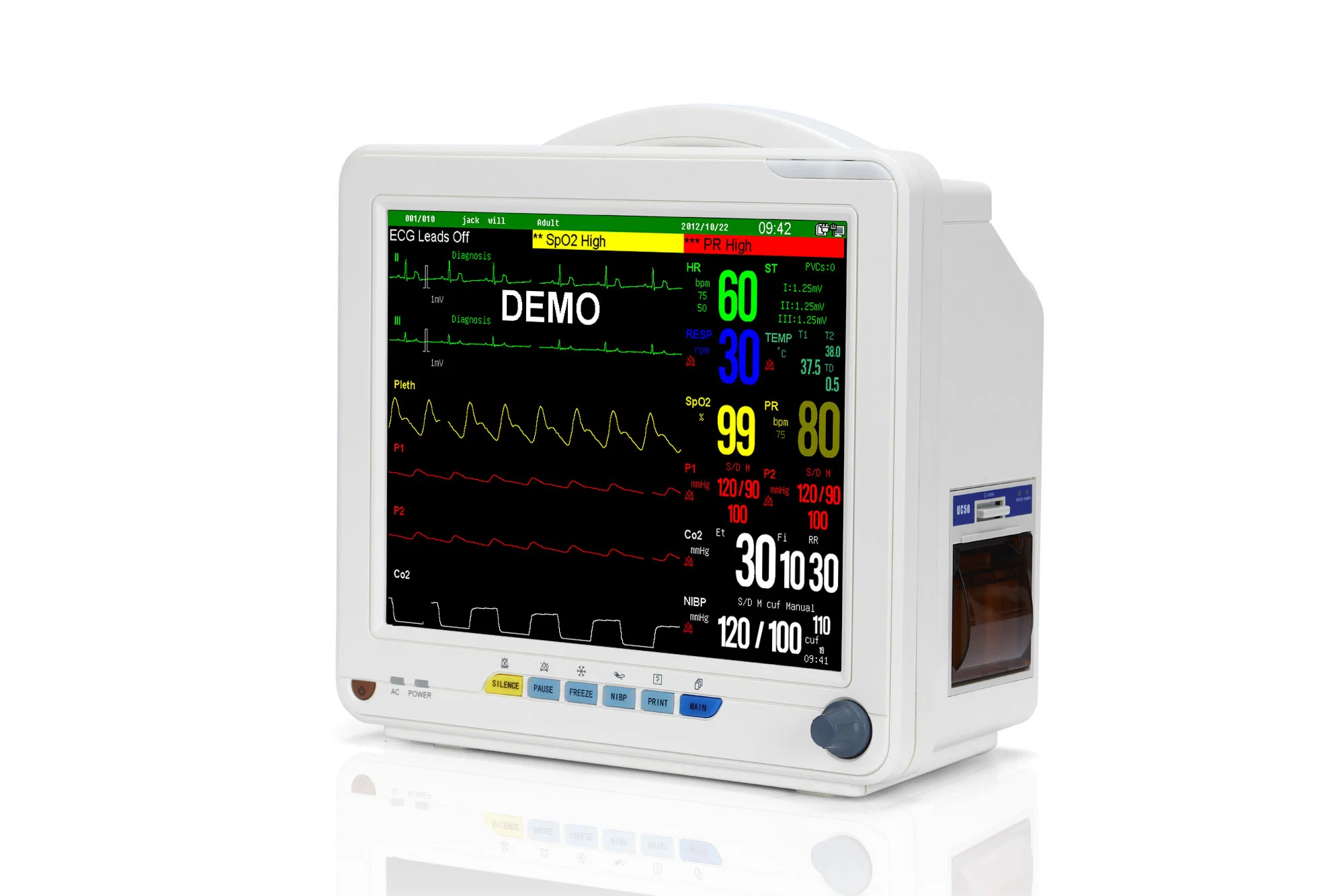 Медицинские портативные ICU Multiparameter пациентов мониторы для больницы