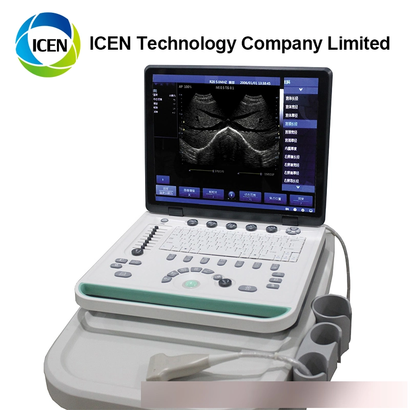 IN-A032-2 ICEN Portable Digital Ultrasound Machine Pregnancy Equipment