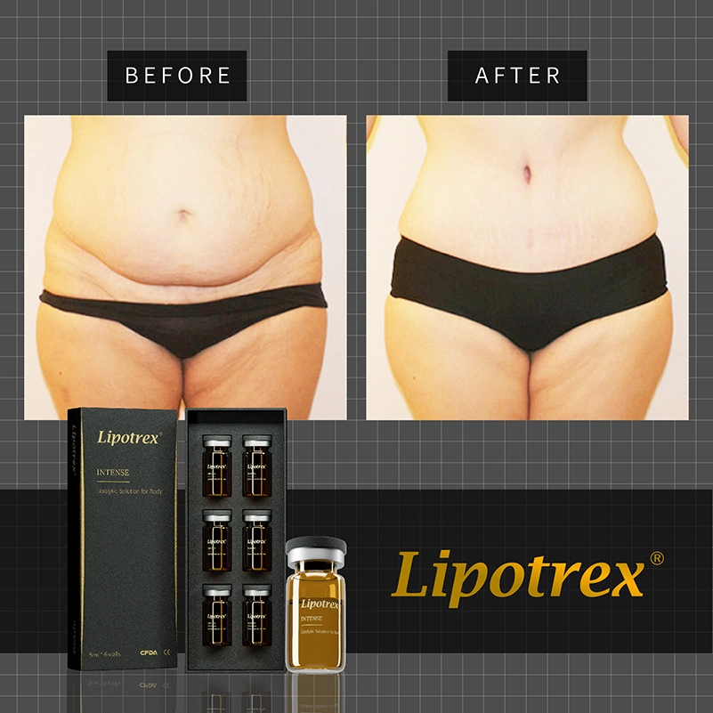 Lipotrex solution lipolytique dissolution de la graisse injection L-Carnitine pour perte de poids Solutions