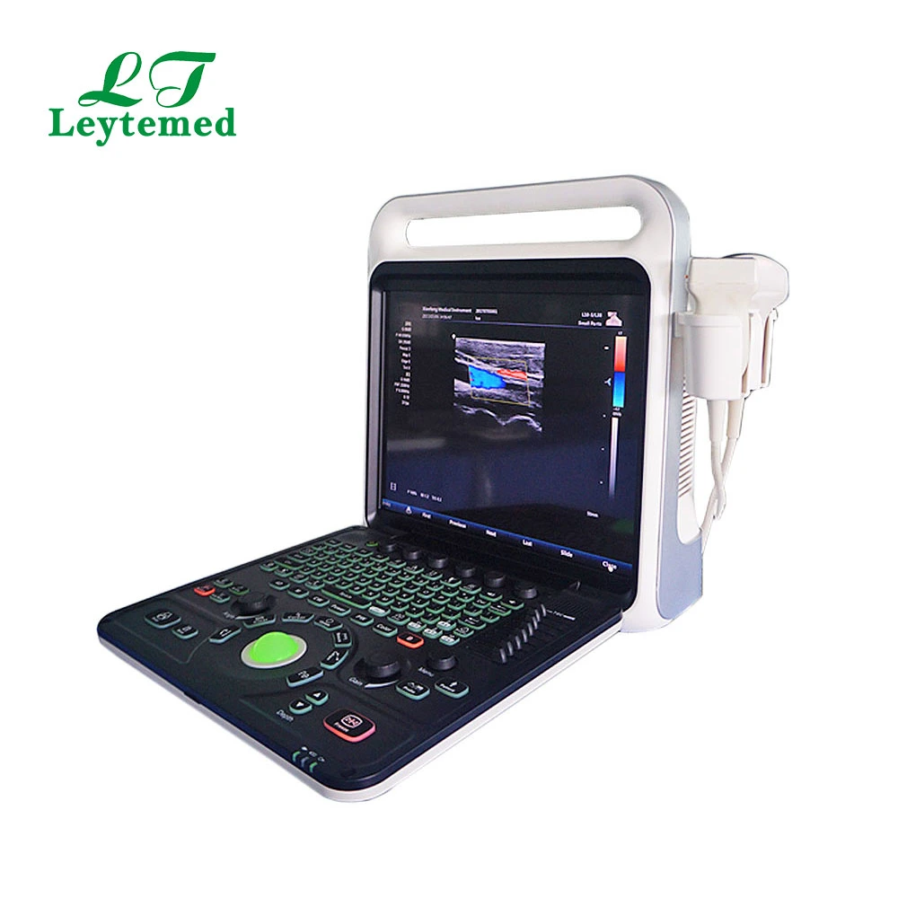 Ltub64 Medical Gynecology Obstetric Full-Digital USB Color Doppler Ultrasound USG