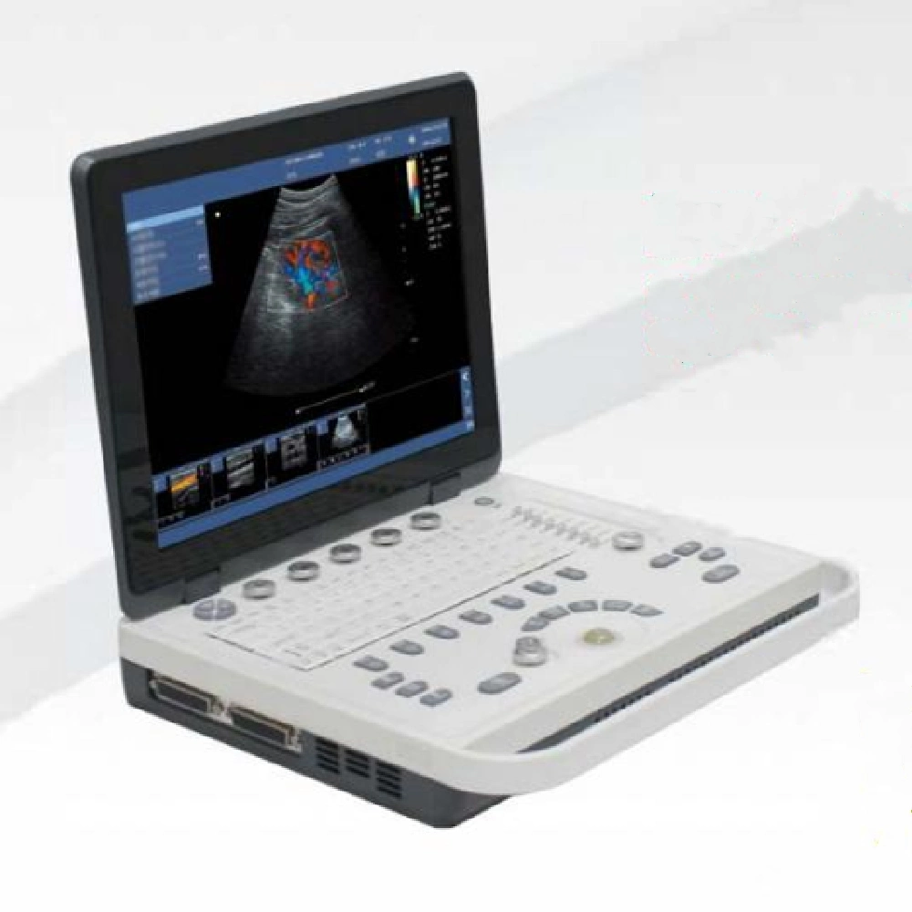 Medical Vet 4D Color Doppler Portable Ultrasound Scannere Machine