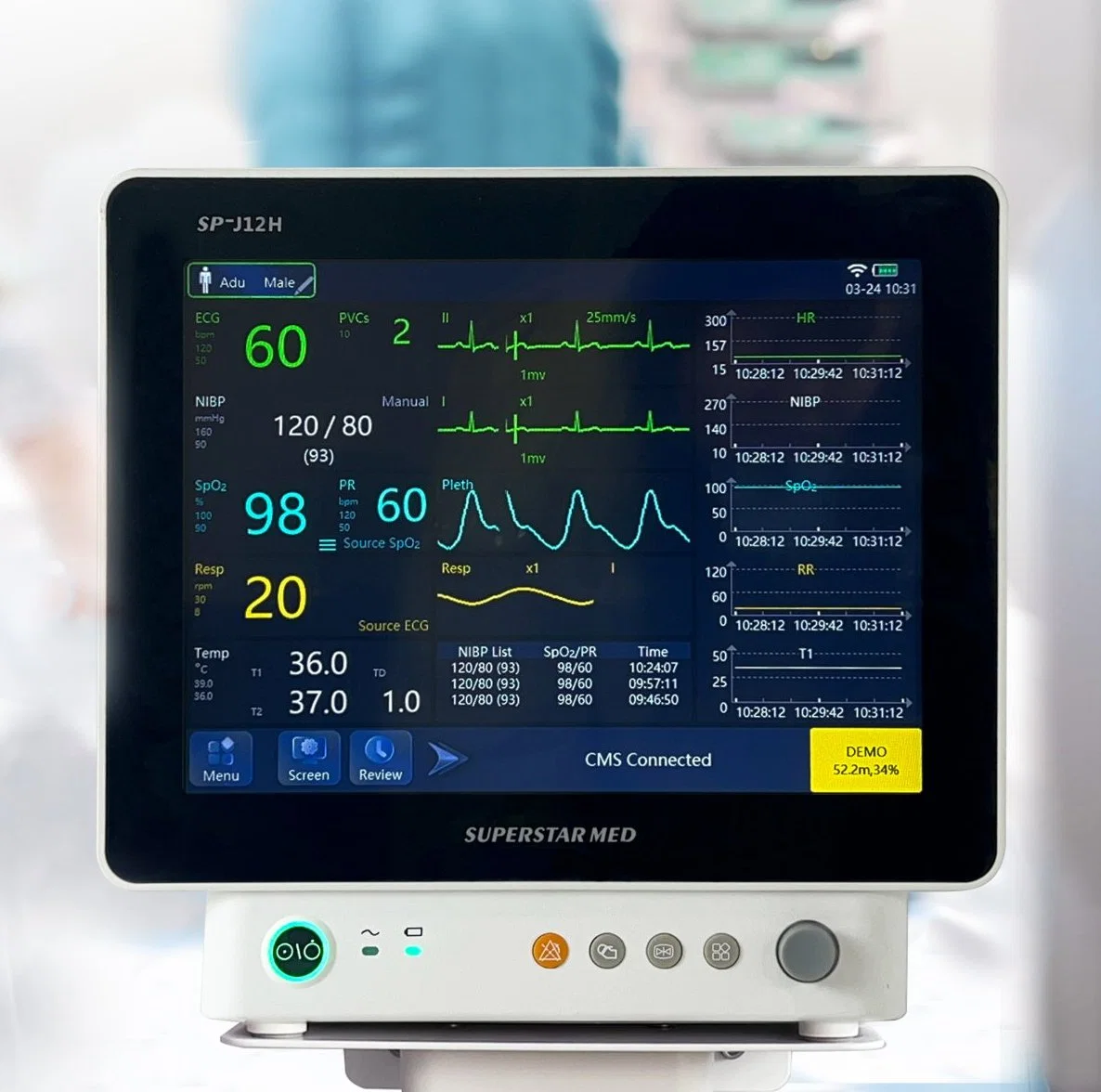 Advanced Multiparameter Patient Monitor System for ICU and Operation Room