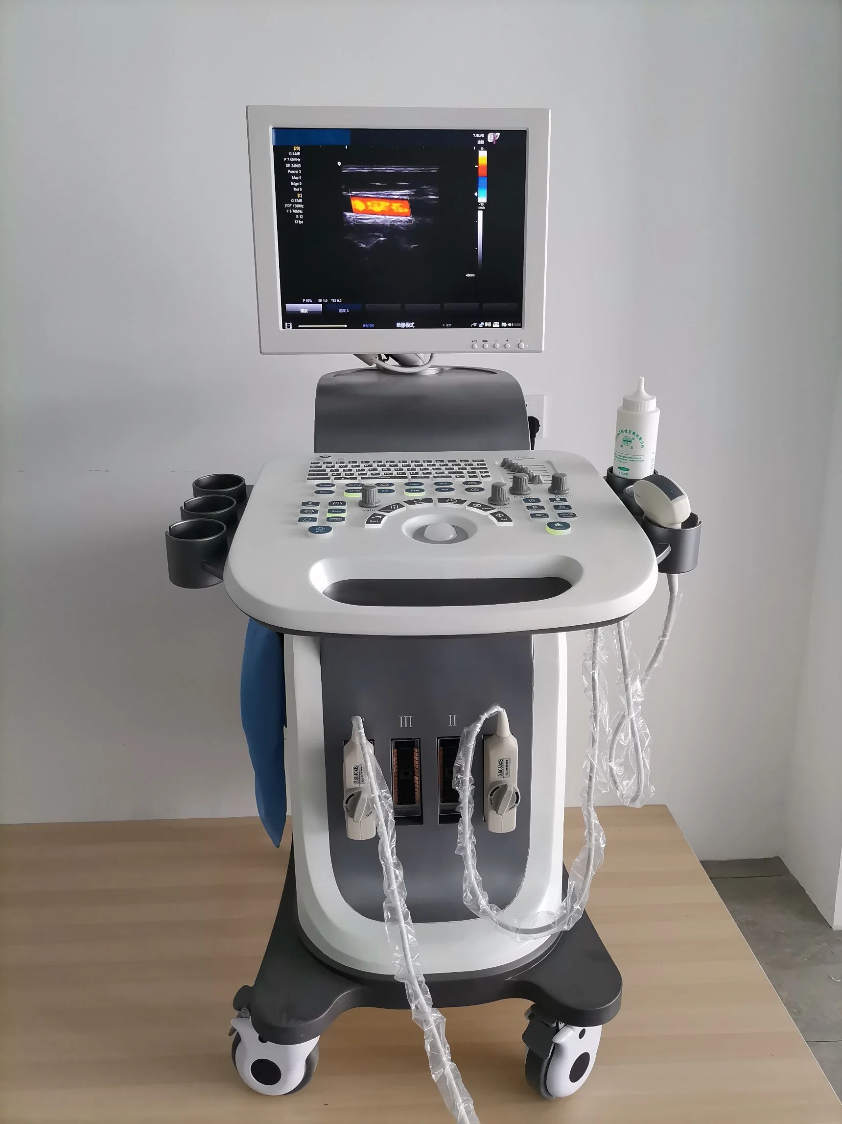 Ltub66 China Manufacture Gynecology Obstetric Trolley 15-Inch Color 4D Ultrasound Machine