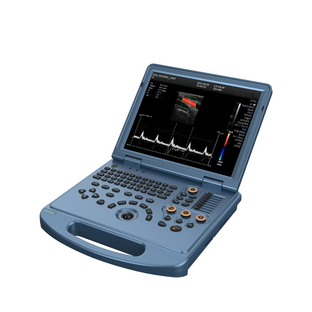 Medical New Type Laptop Laptop Color Doppler Ultrasonic Diagnostic System with Rechargeable Battery