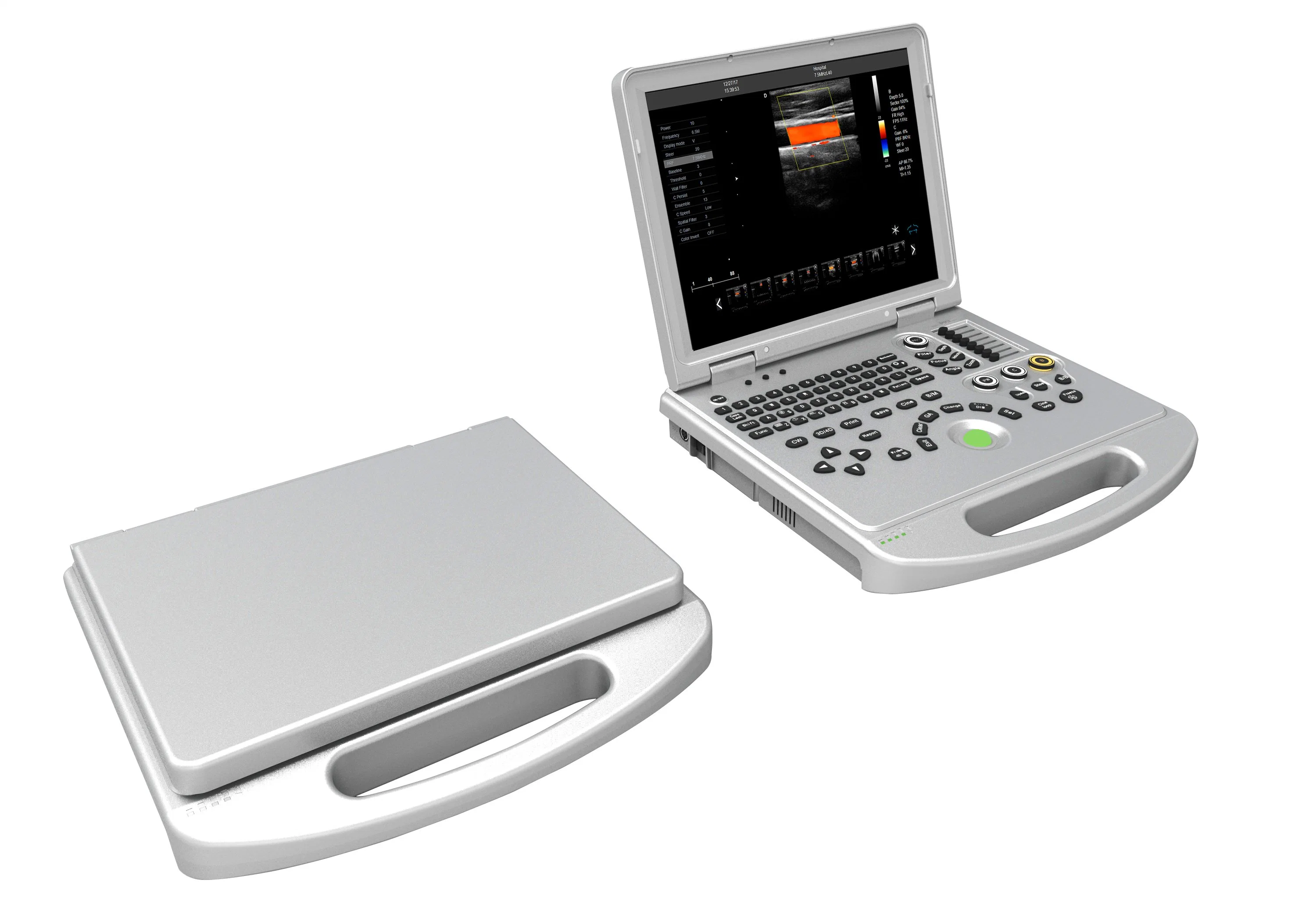 Medical Equipment Hospital Use Color Doppler Ultrasound System Portable Ultrasound Scanner