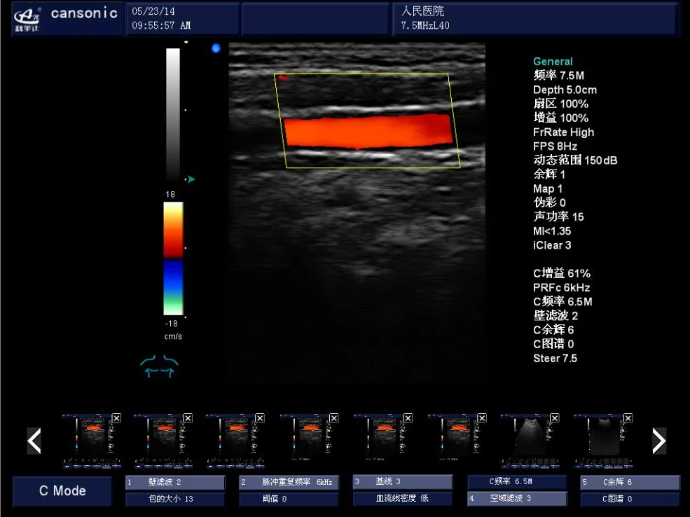 ماسحة ضوئية تعمل بالموجات فوق الصوتية (K10) ذات الاستخدام الرقمي الكامل