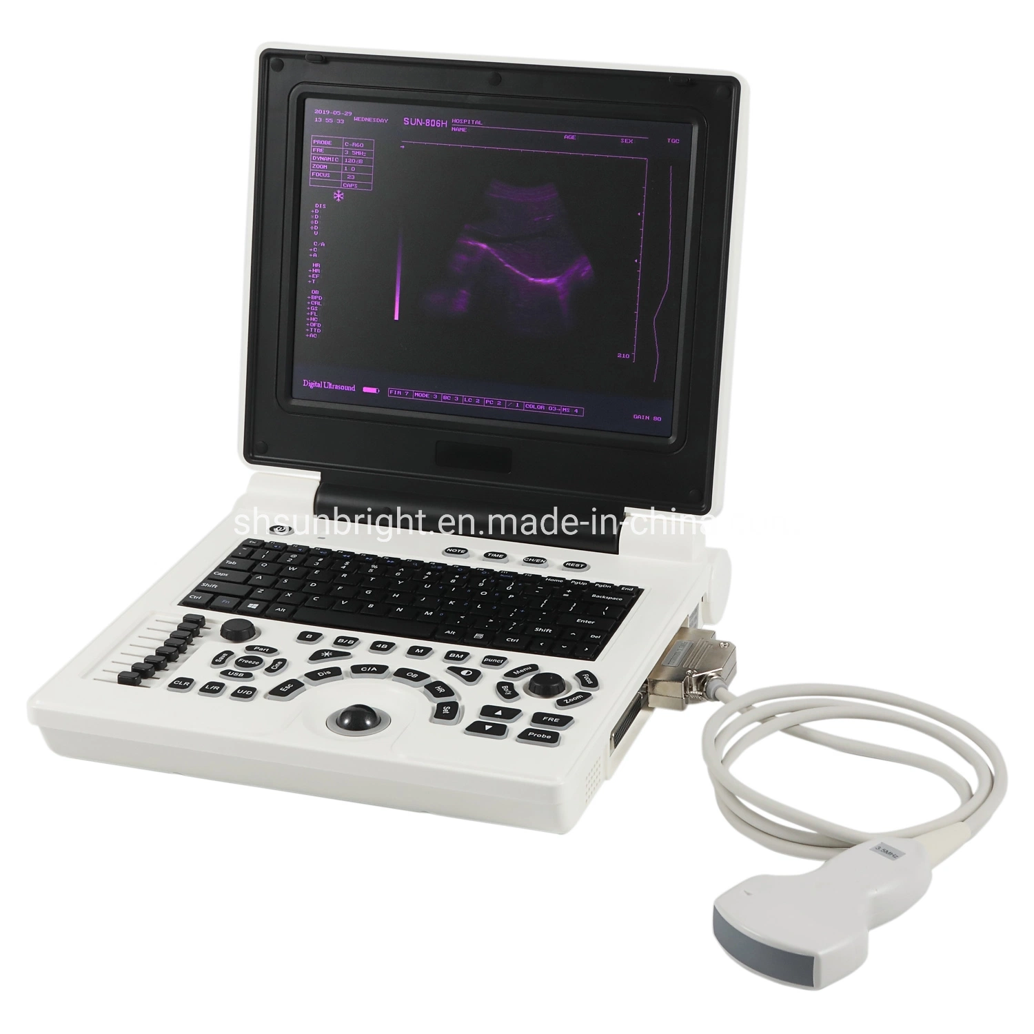 China Medical Note Book Ultrasound Device Veterinary Ultrasound Instrument