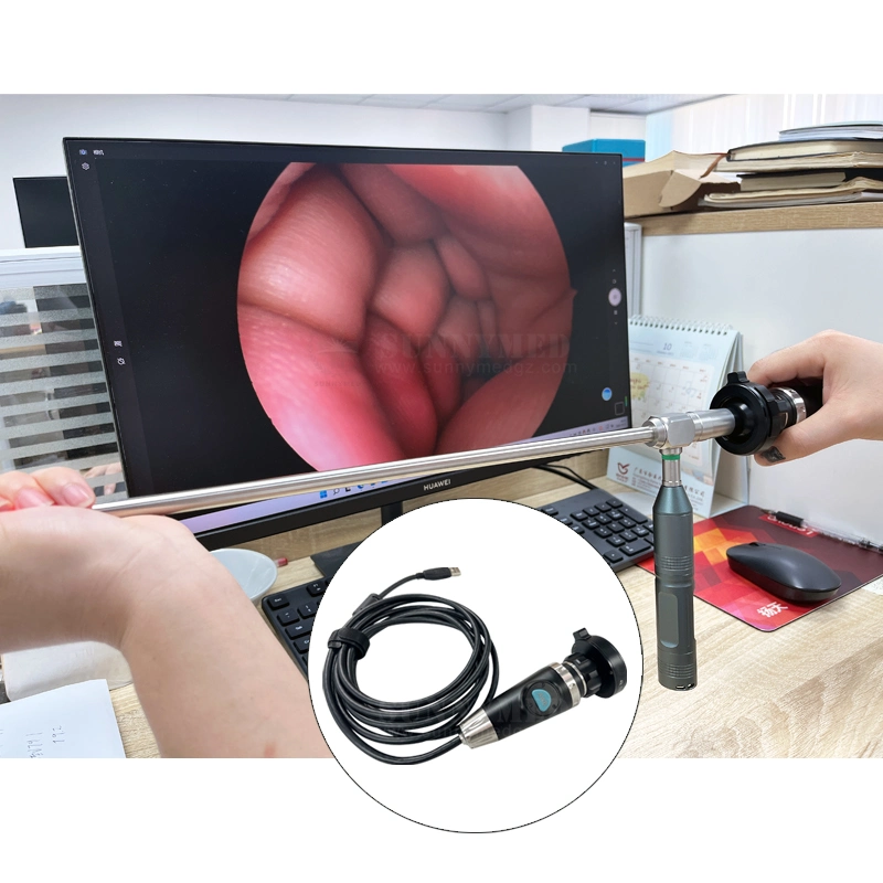 Sy-P031HD3 Fully HD Potable Medical Equipment HD USB Endoscope Camera with USB Supporting Home TV