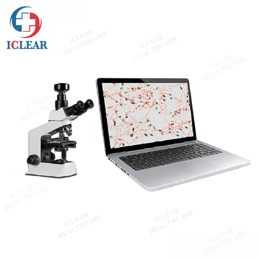 4ª Versão de Software Notebook Ultraportátil Análise de sémen Analisador de esperma para uso de EFP