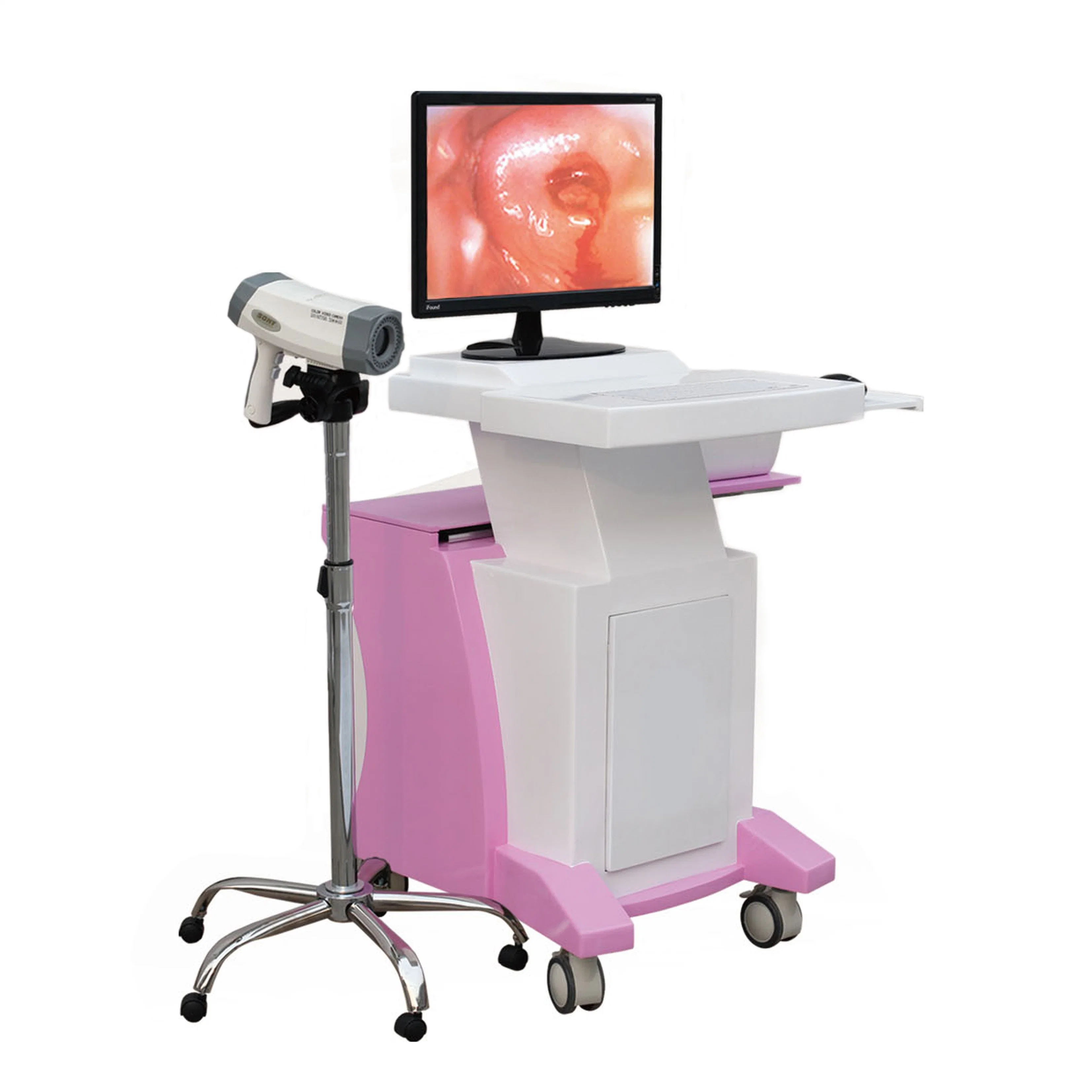 in-G8000c Digital Electronic Vagina Video Colposcope Camera for Gynaecology