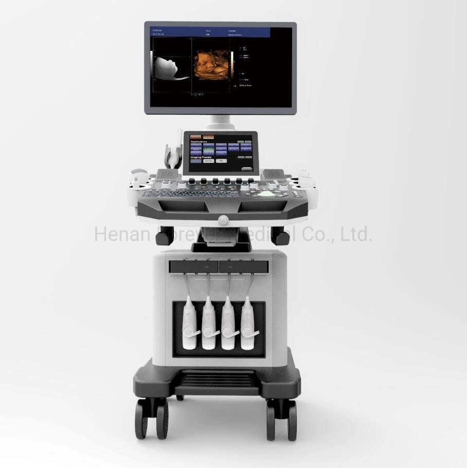 Cardio médico Carrito Sistema de ecografía Doppler Color Digital