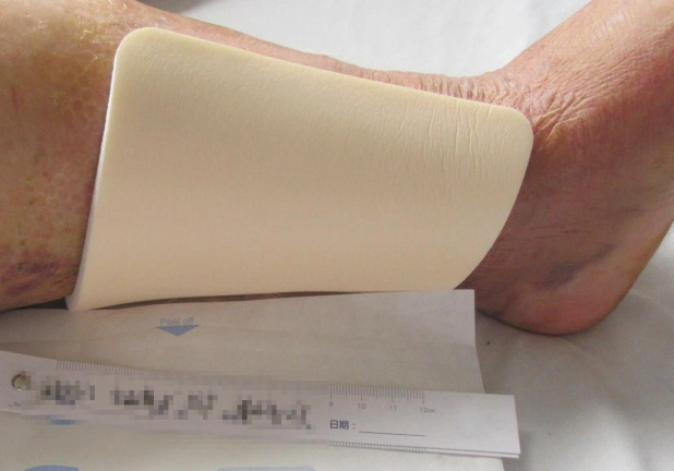 Medical Soft Bandage PU Foam Wound Dressing Without Border