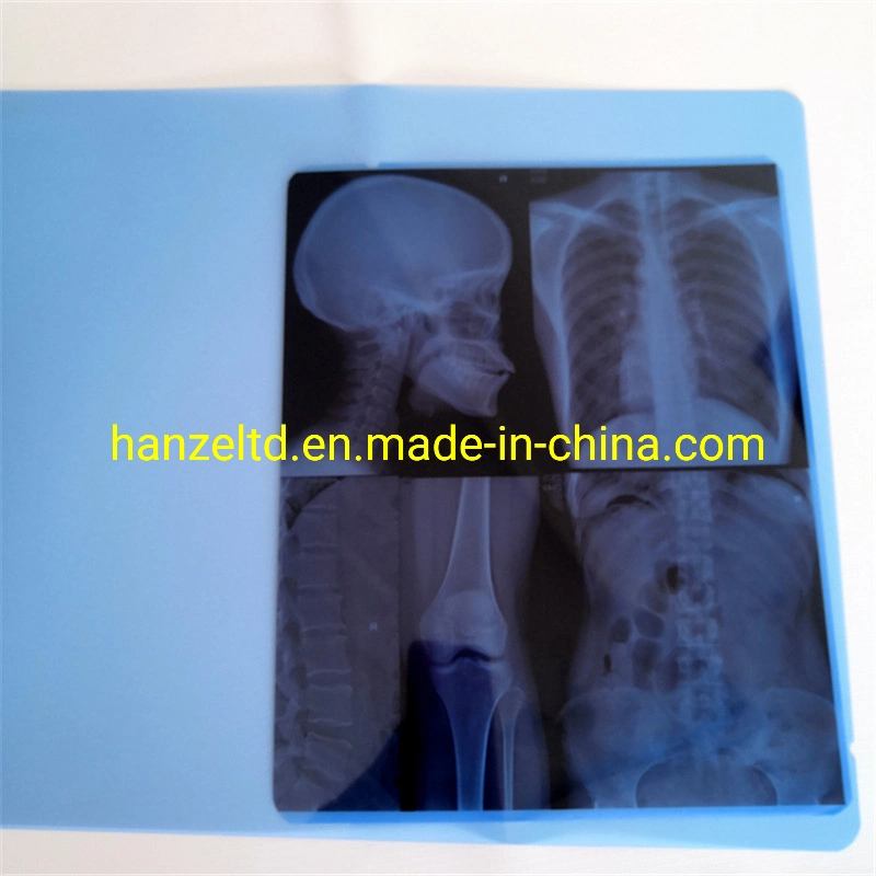 PET Medical Inkjet X-ray Blue Film Preis