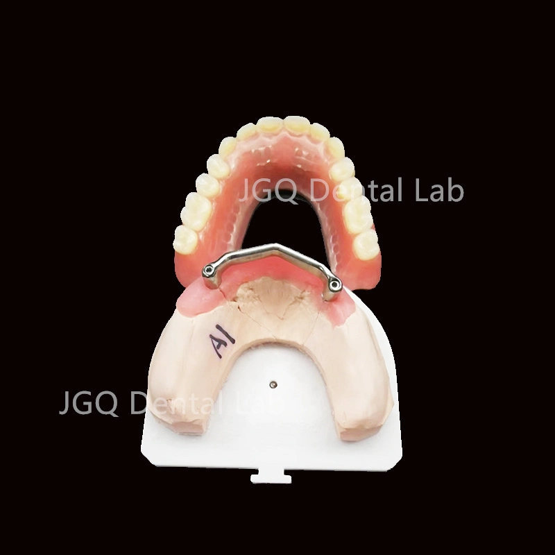 China Dental Lab Custom Quality All on 4 Implant Bar Pure Titanium Material