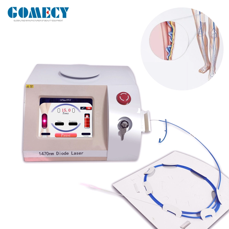 15W Medical CE 1470nm Endovenous Vein Laser Evltevla Diode Laser Device Endovenous Laser Treatment