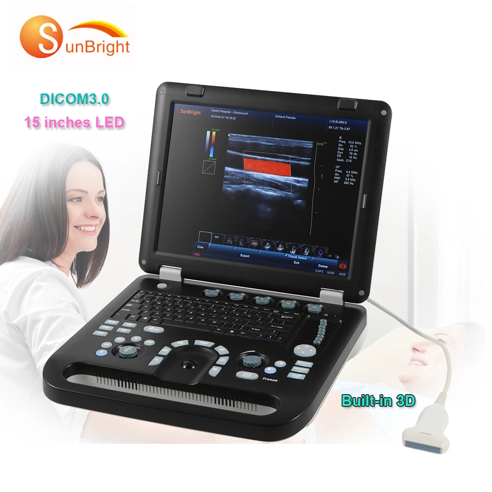 Affordable Low Cost Portable Color Ultrasound Machine Pw Doppler Device