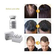 Aape Efficient Hair Growth Products factores de crecimiento de células madre Anti Tratamiento de la pérdida de cabello para el crecimiento del cabello de Bald humano el mejor crecimiento del cabello Productos