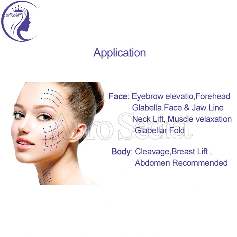 Best Price V Line Face Lift Treatment Pdo Thread Lifting