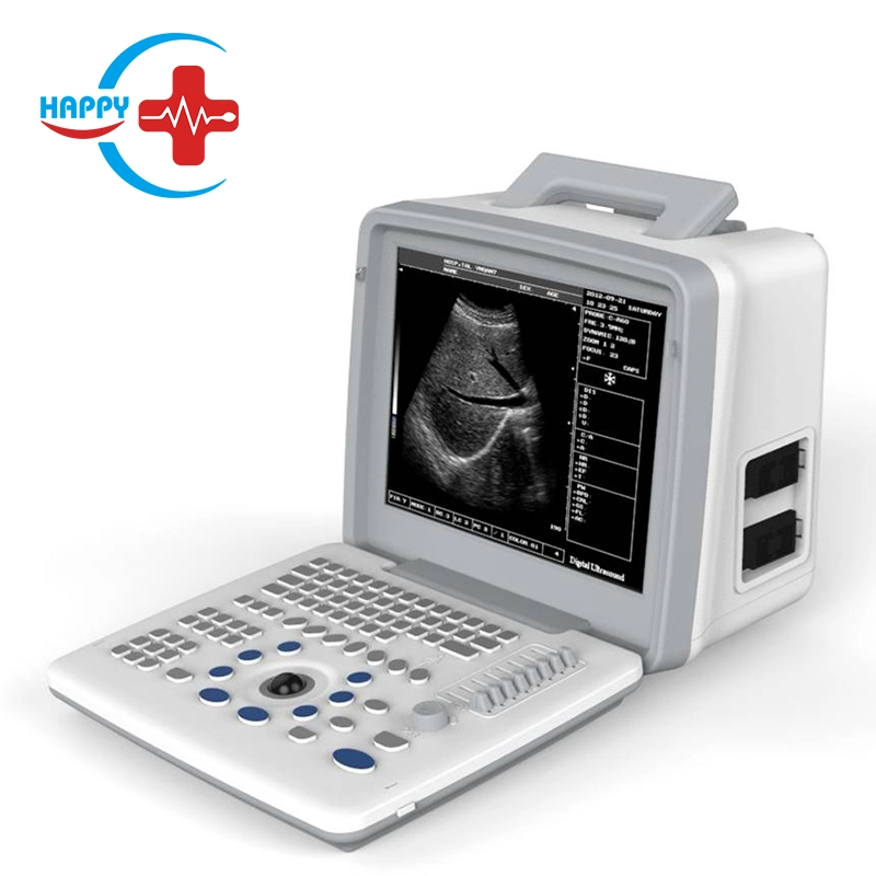 HC-A002 Manufacturer Direct 10 Inch 2 Convex Prode Connectors LED Full Digital Ultrasound Scanner with Permanent Storage