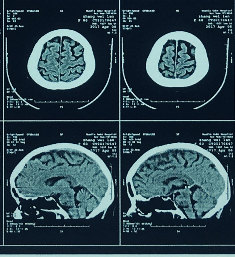 Radiology Medical Dry Film/Dry Thermal Film 35X43 Cm