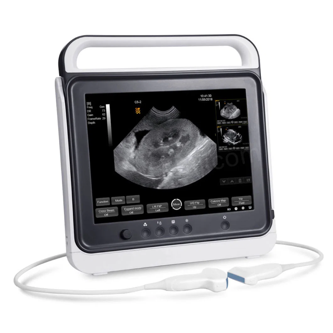 High Definition Image Digital Portable Ultrasound Scan Machine for Human Animals