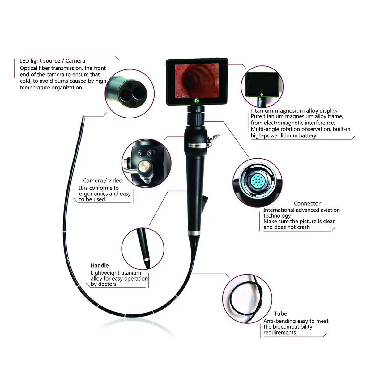 HD Wireless Endoscopic Camera 4K Portable Ent Endoscope Camera System