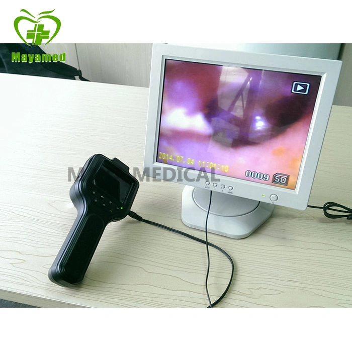 My-G044c Portable Medical Digital Otoscope