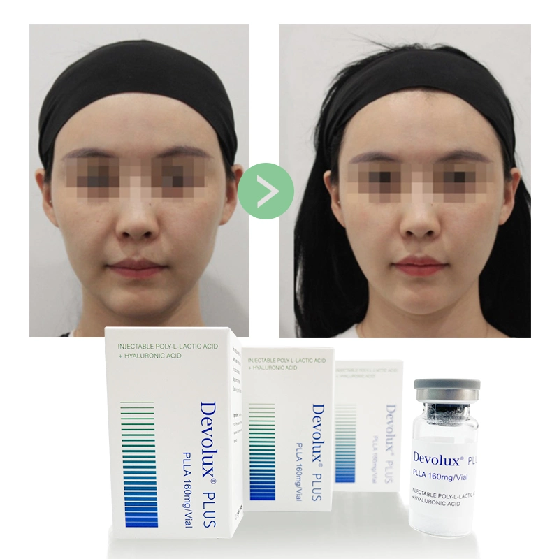 Devolux Reborn Poly L Lactic Plla Filler PARA Cara Inyectable for Anti-Aging