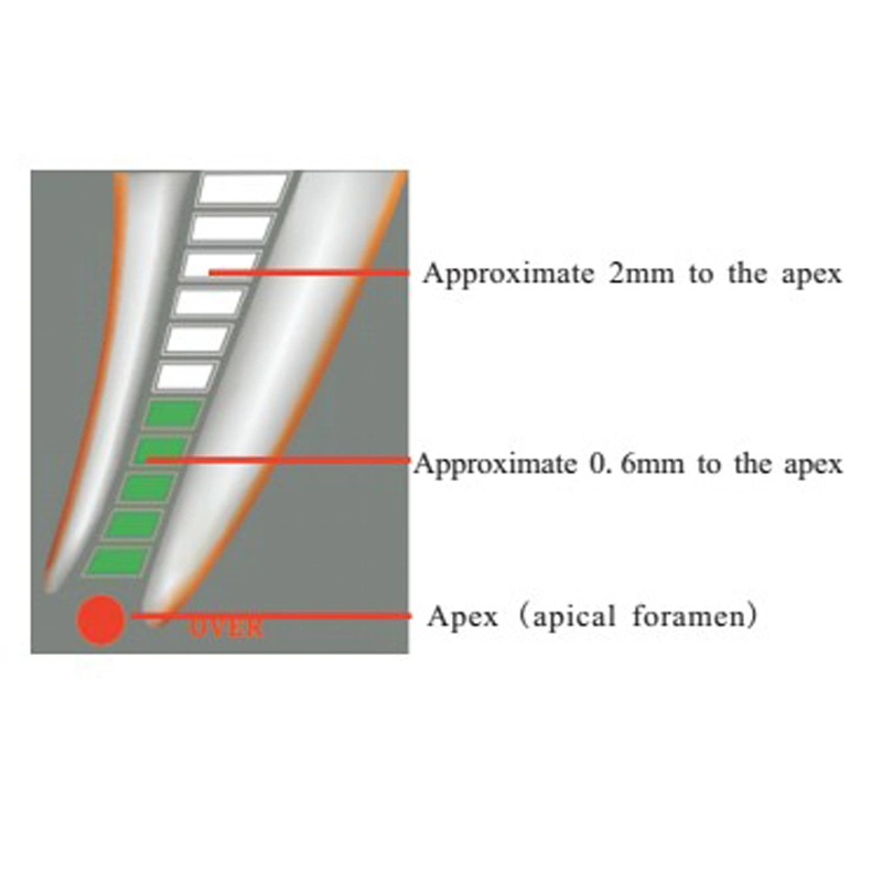 Root Carnal Equipment Dental Apex Locator