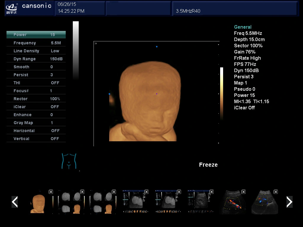 Color Doppler Ultrasound Scnaner with Good 4D Image Resolution