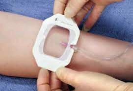 Adhersive Gauze Wound Dressing Transparent Adhesive Individual Packing Wound Covering