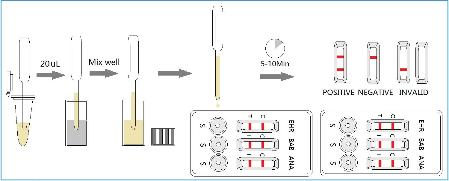 Combo de garrapatas la Ehrlichiosis Babesiosis Kit de Prueba rápida de la anaplasmosis