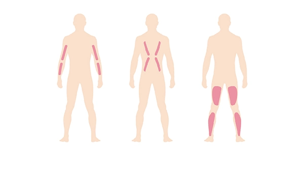 Equipamento de Fisioterapia do dispositivo de estimulação do nervo músculo RTE