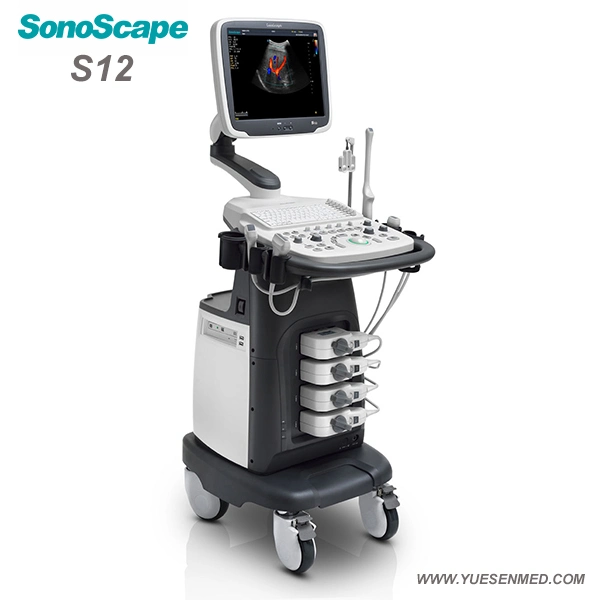 Hospital Medical Trolley 4D Color Doppler Sonoscape S12