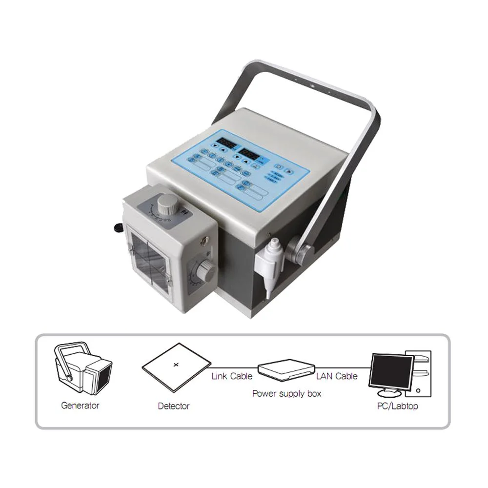 5kw/8kw Portable Digital X-ray Machine Wireless 14*17 Fpd